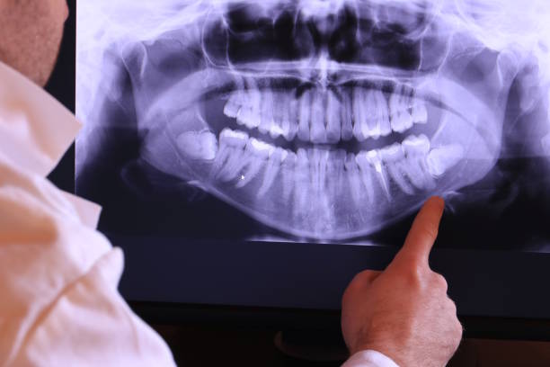 Best Pediatric Emergency Dentist in Elizabeth Lake, CA
