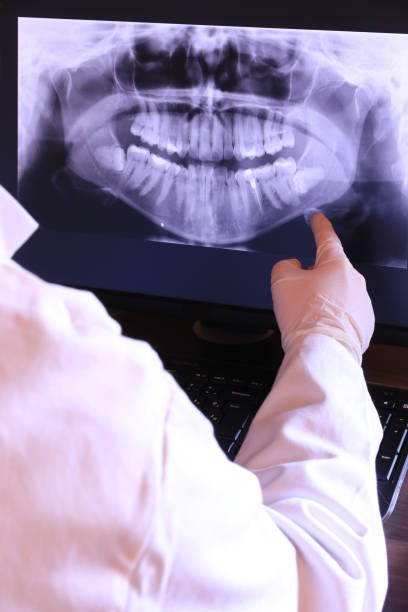 Best Broken or Cracked Tooth Emergency Dentist in Elizabeth Lake, CA